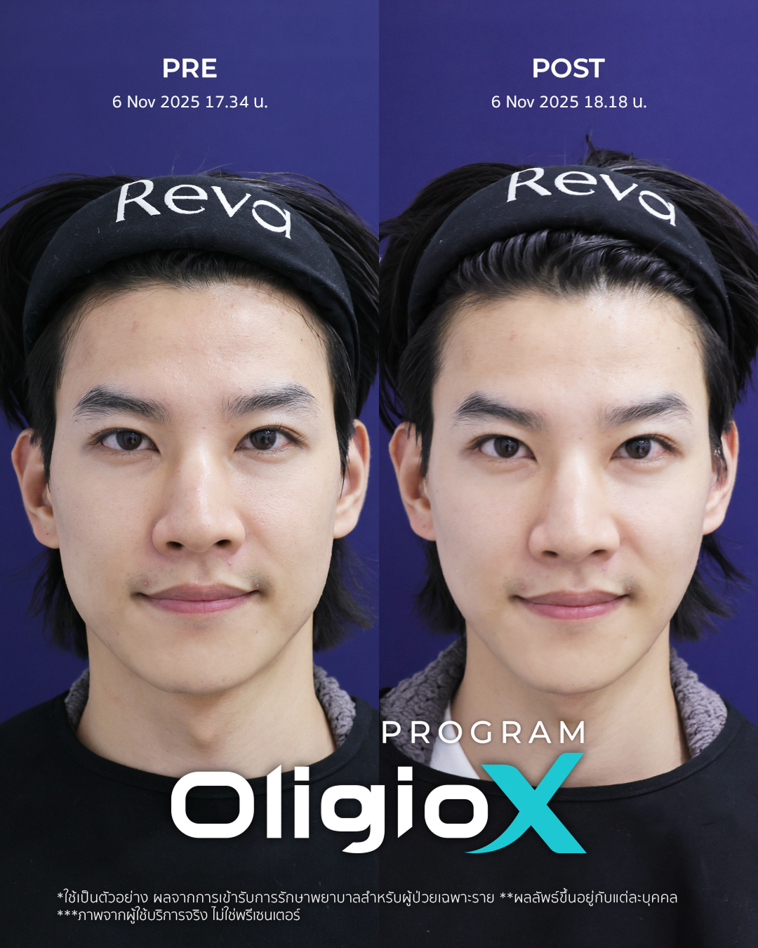 Reva Clinic Review 1