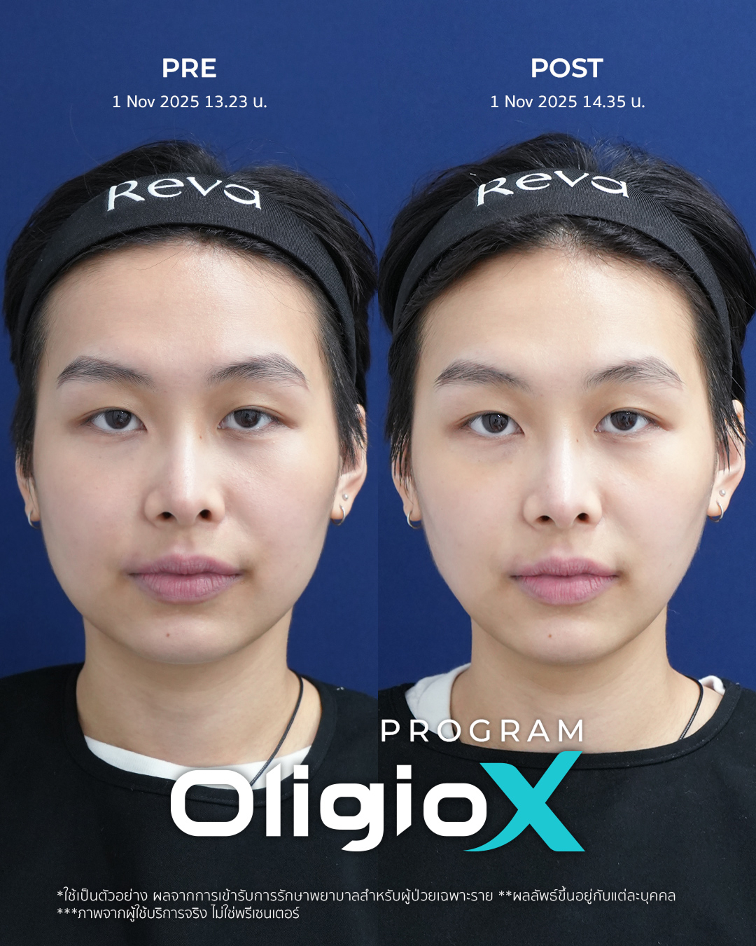Reva Clinic Review 2