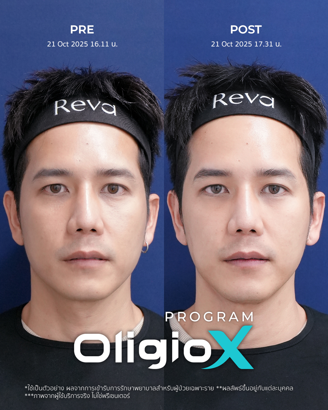 Reva Clinic Review 3