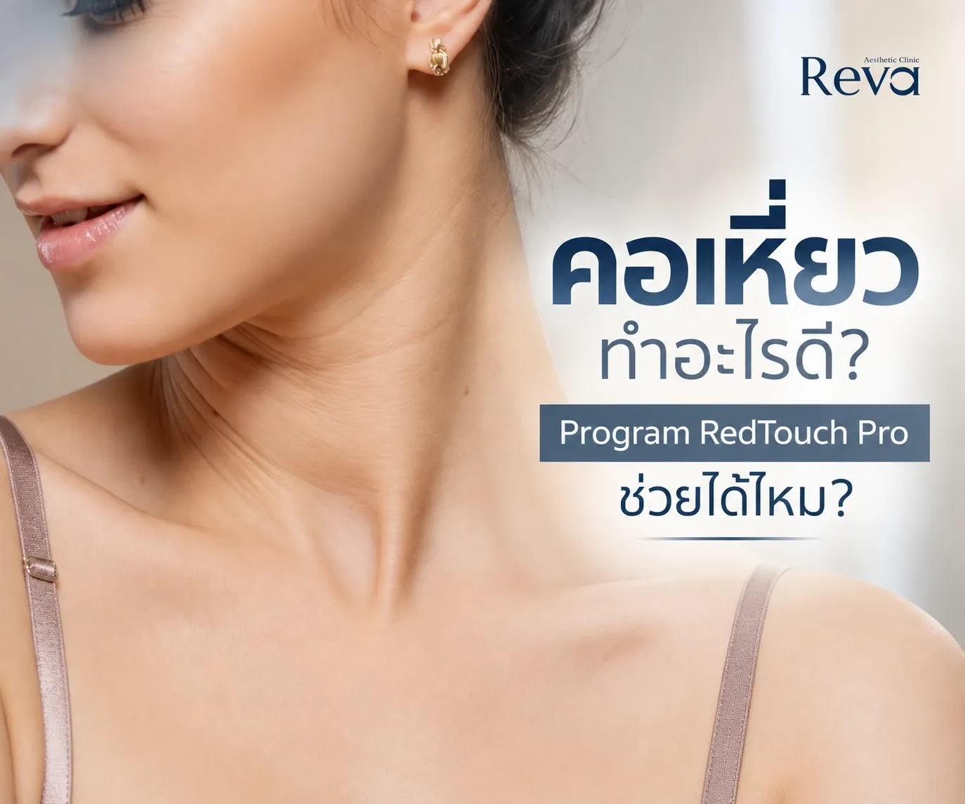 Redtouch คอเหี่ยว
