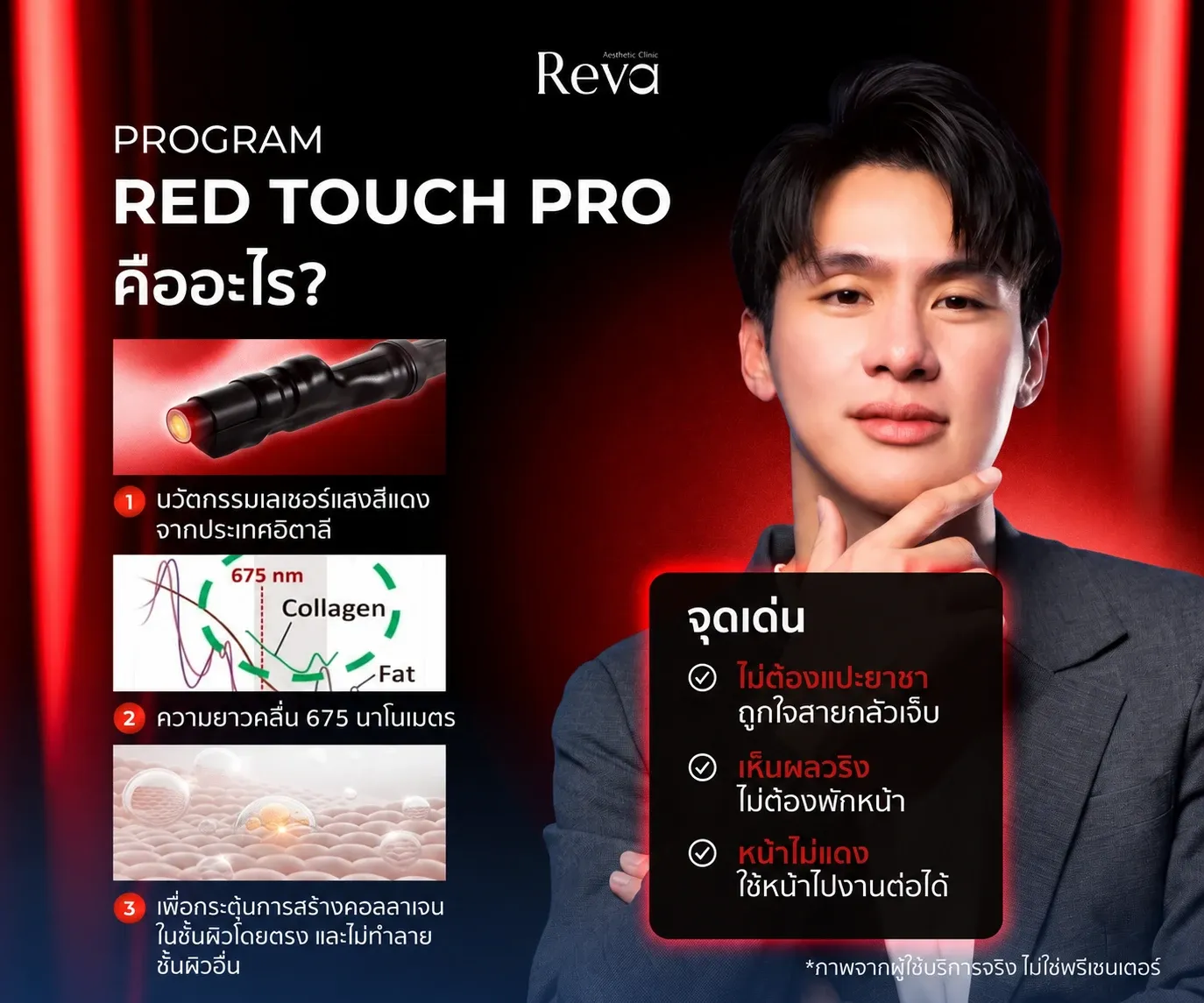 โปรแกรม Red Touch คืออะไร? ทำงานอย่างไร พร้อมเจาะลึกการทำคู่กับ Vitaran i | Reva Clinic
