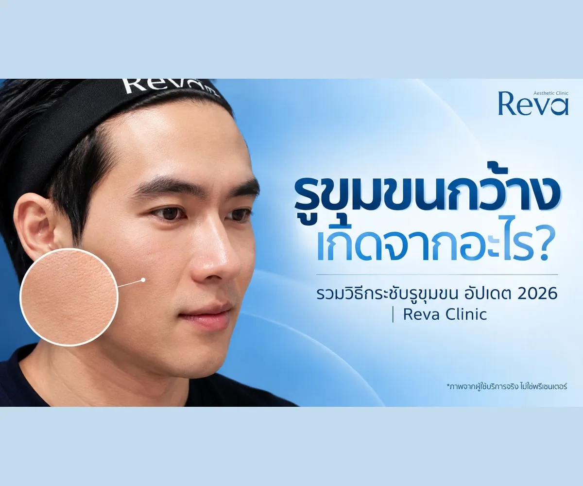 รูขุมขนกว้าง