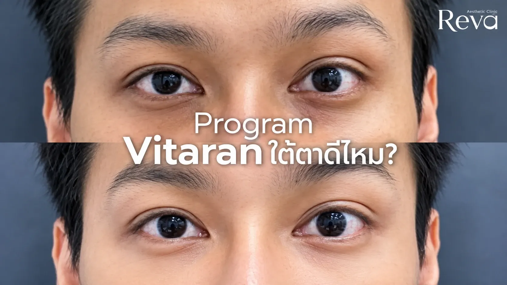 Vitaran ใต้ตาดีไหม