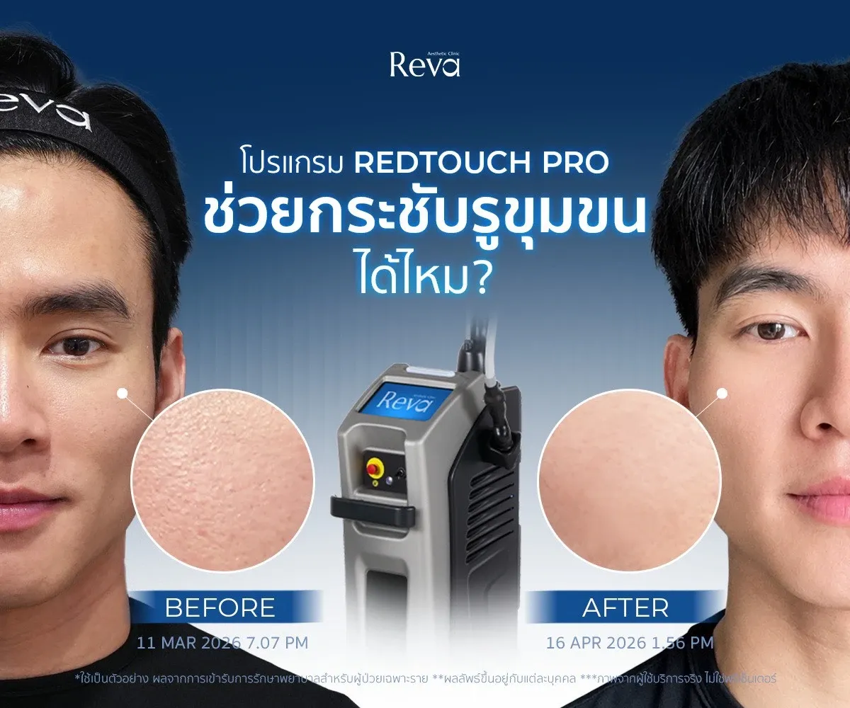 โปรแกรม RedTouch Pro ช่วยกระชับรูขุมขนได้ไหม?