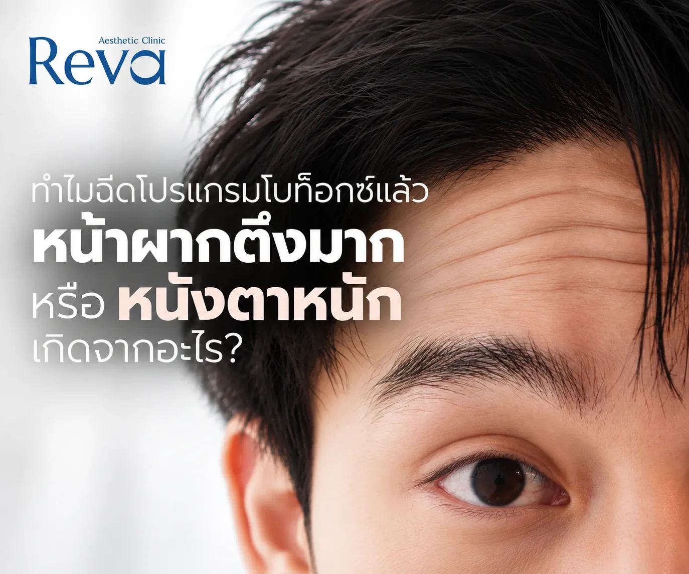 ฉีดโปรแกรมโบท็อกซ์แล้วหนังตาหนัก