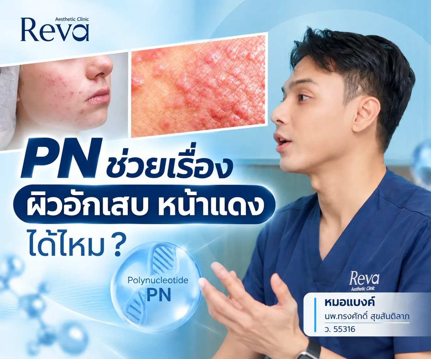 PN ช่วยลดผิวอักเสบ หน้าแดง