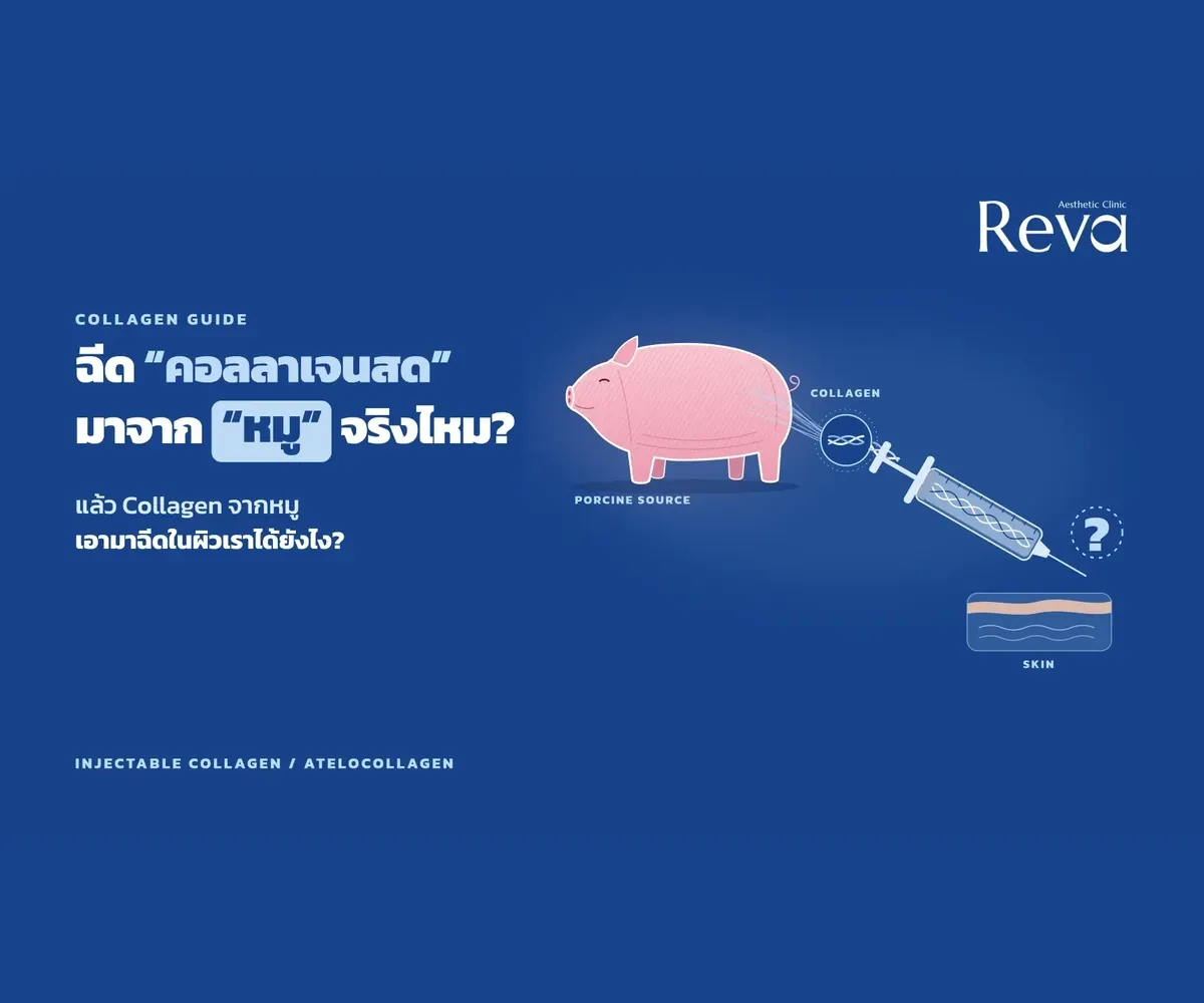 ฉีดคอลลาเจนสดคืออะไร