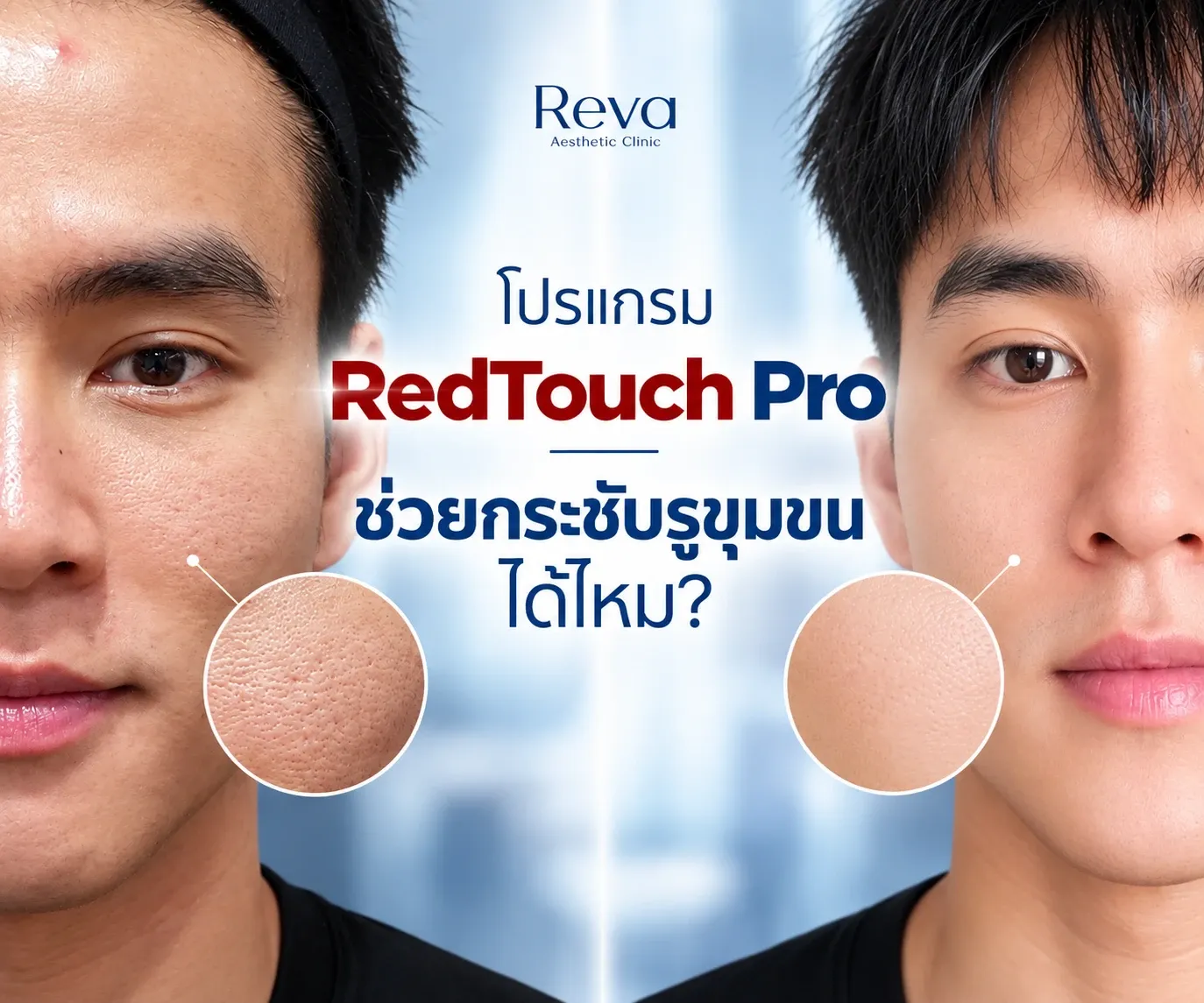 โปรแกรม RedTouch Pro ช่วยกระชับรูขุมขนได้ไหม?