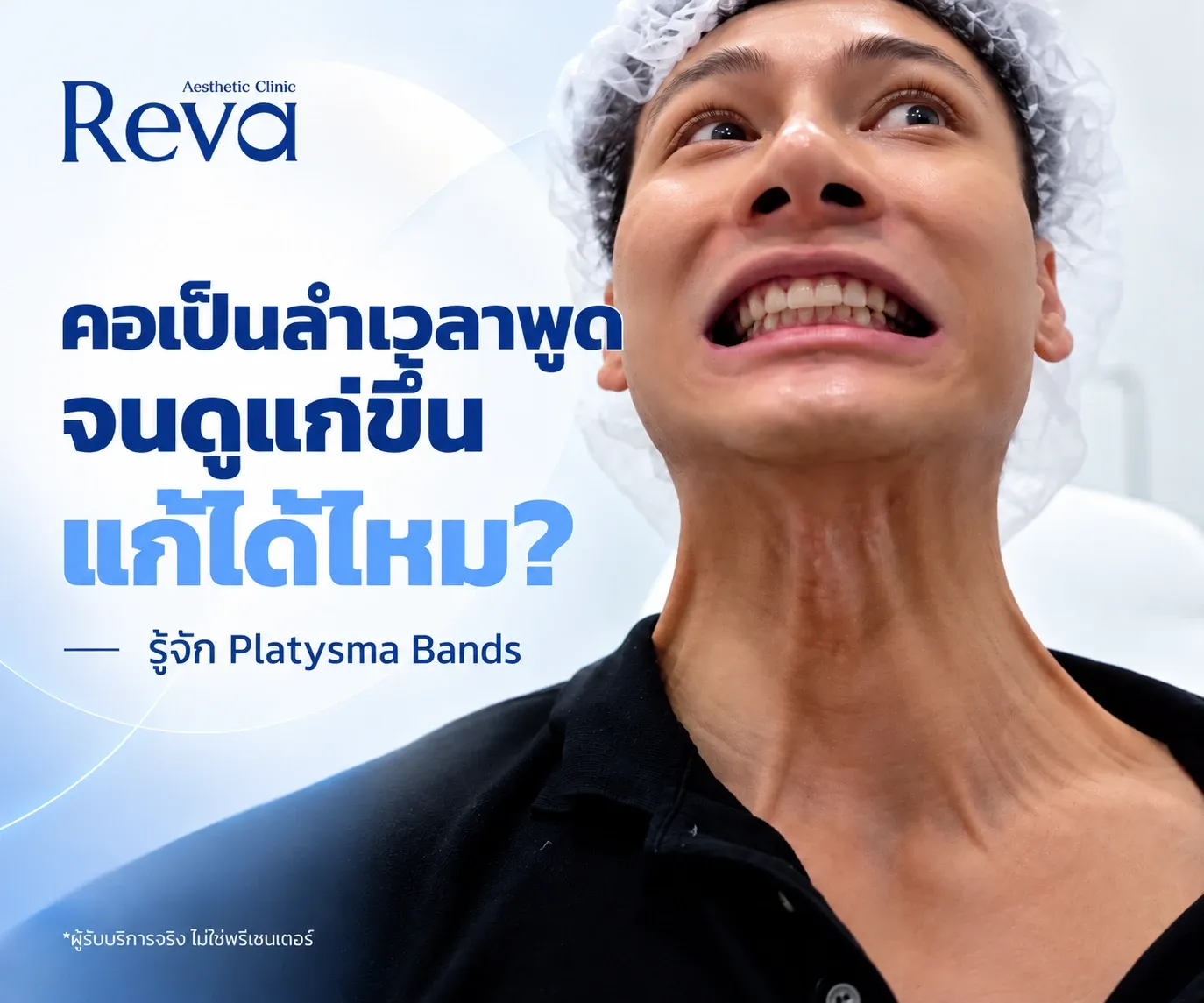 Platysma Bands และวิธีรักษา