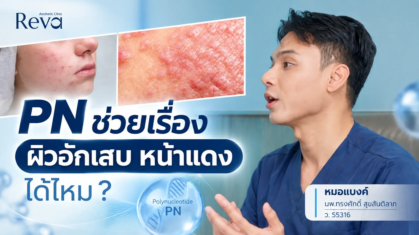 PN ช่วยลดผิวอักเสบ หน้าแดง