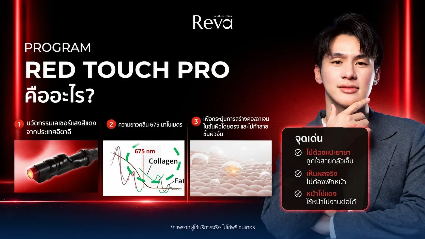 โปรแกรม Red Touch คืออะไร?