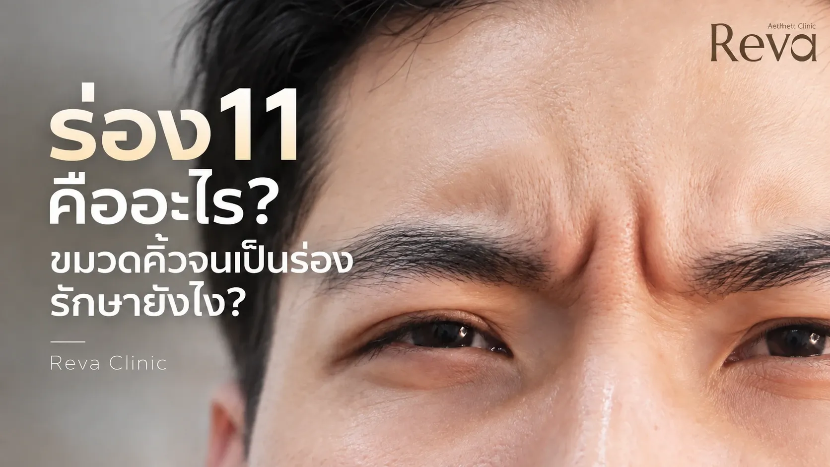 ร่อง 11 ขมวดคิ้วจนเป็นร่อง
