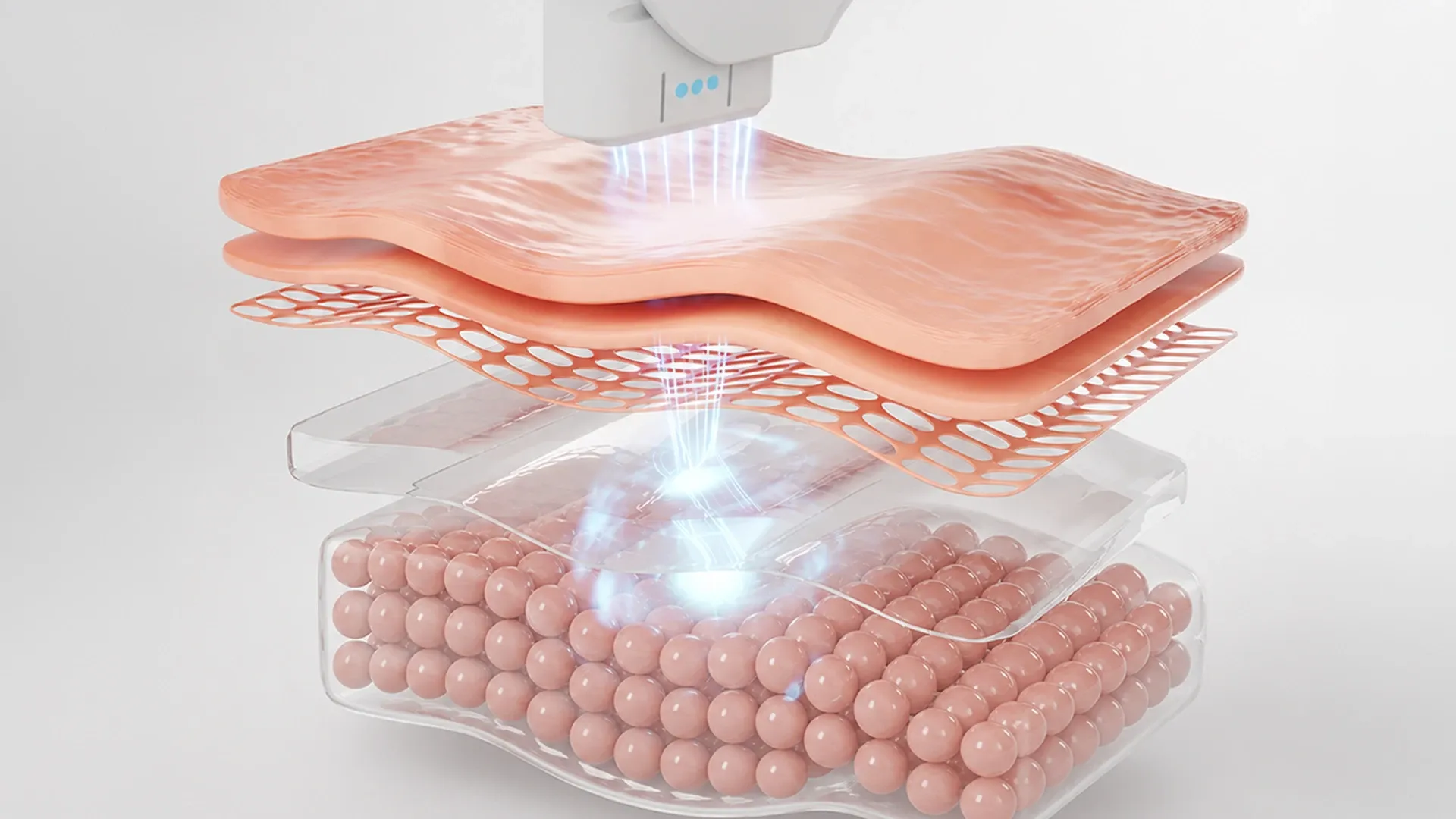 Ulthera SPT ที่ Reva Aesthetic Clinic