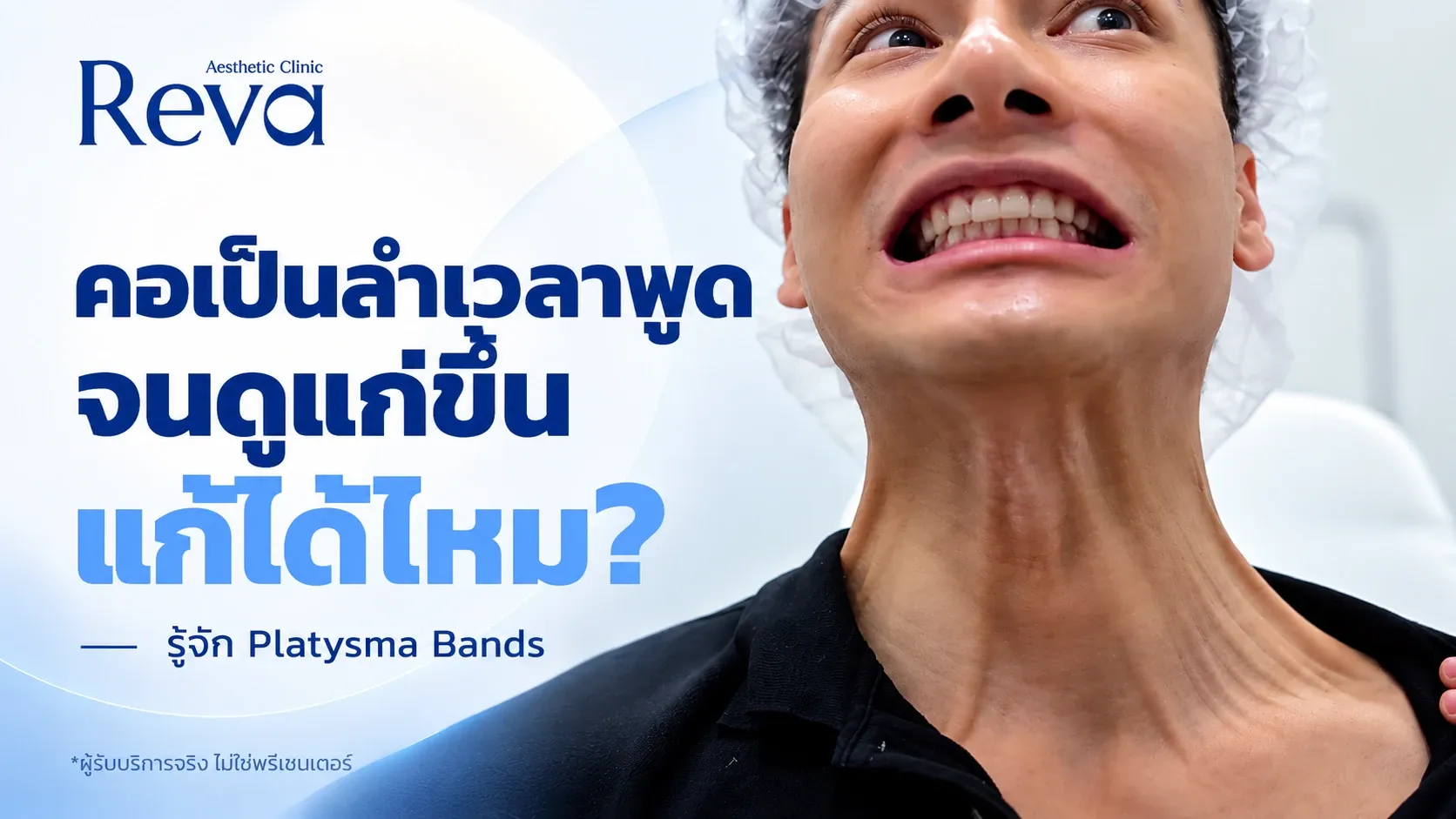 Platysma Bands และวิธีรักษา