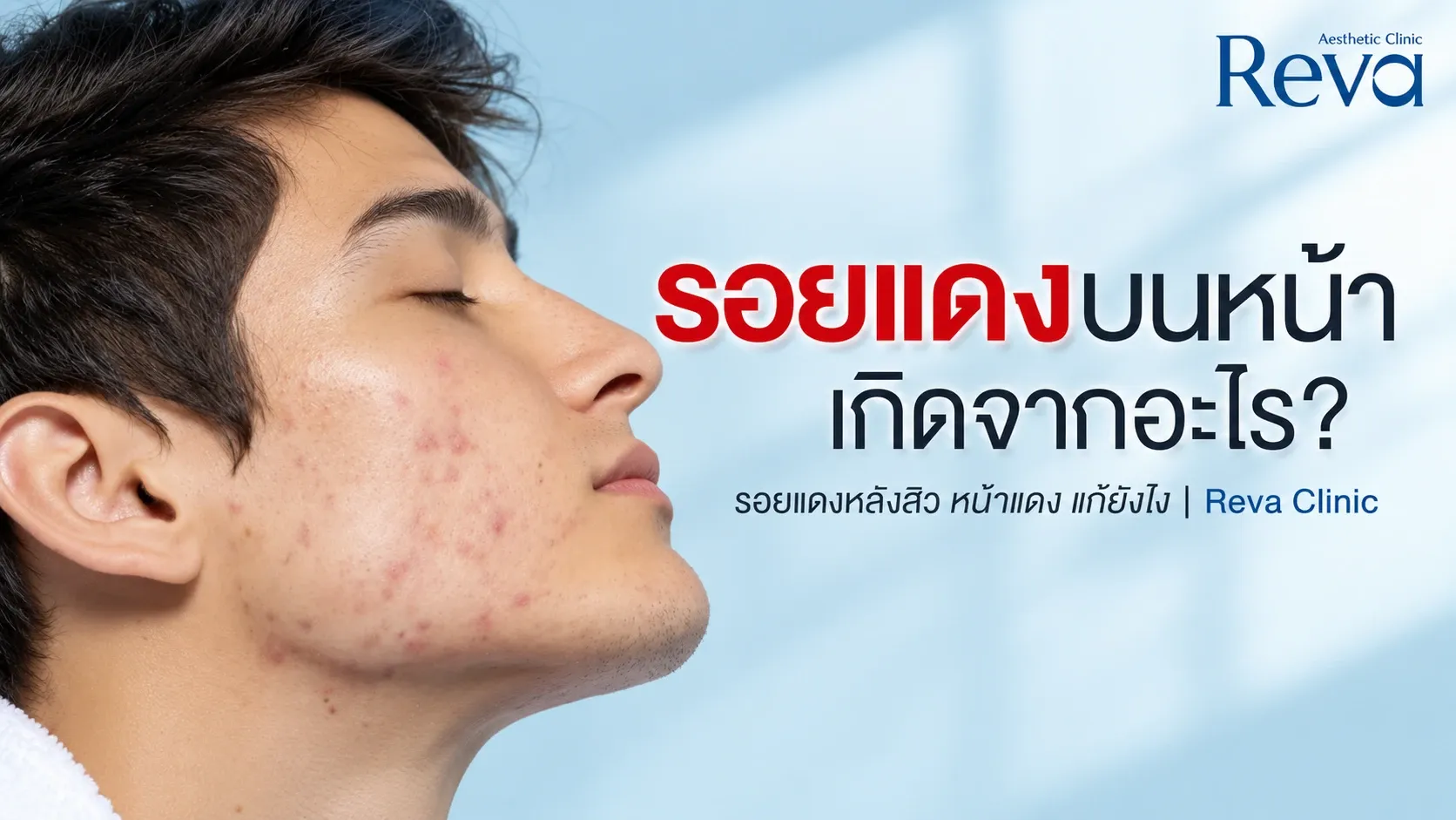 รอยแดง