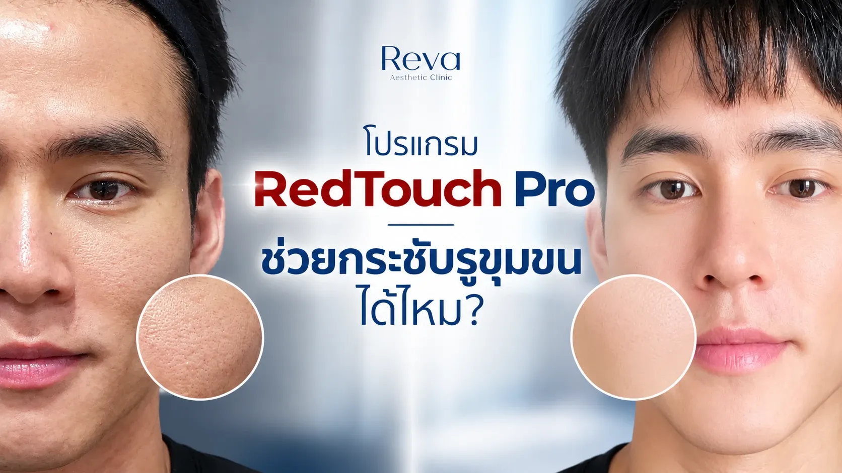โปรแกรม RedTouch Pro ช่วยกระชับรูขุมขนได้ไหม?