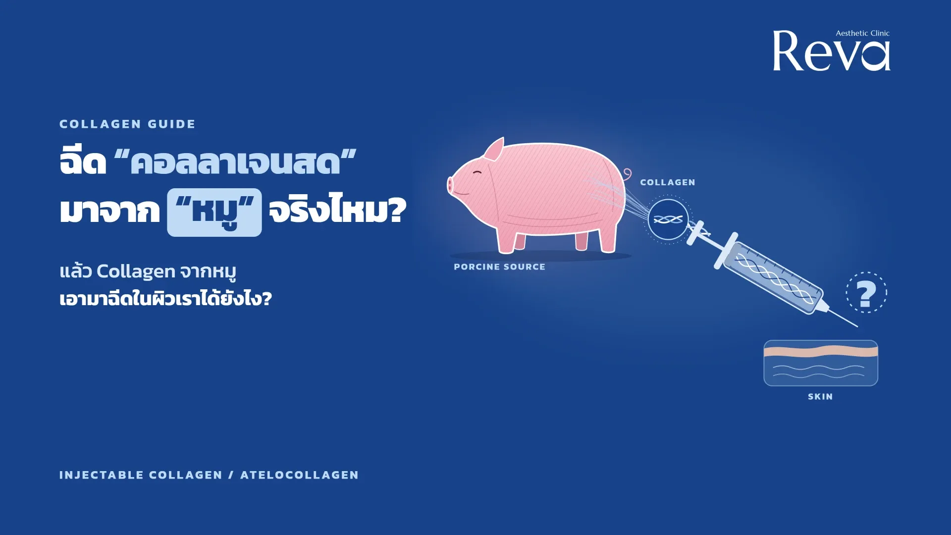 ฉีดคอลลาเจนสดคืออะไร