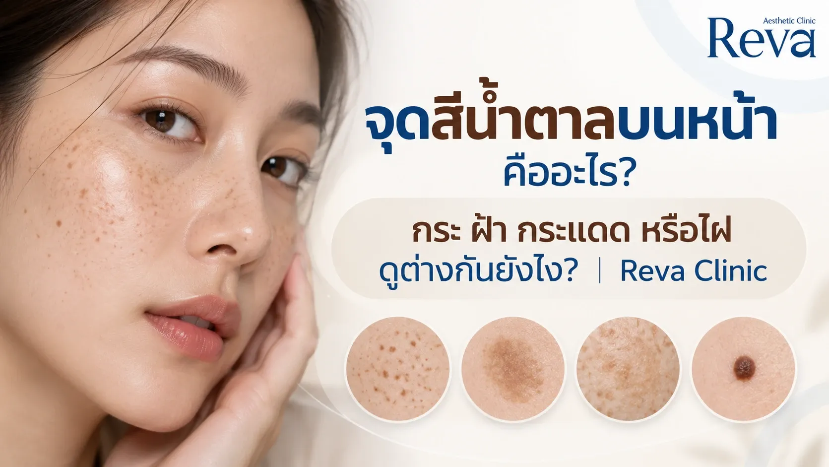 จุดสีน้ำตาลบนหน้า