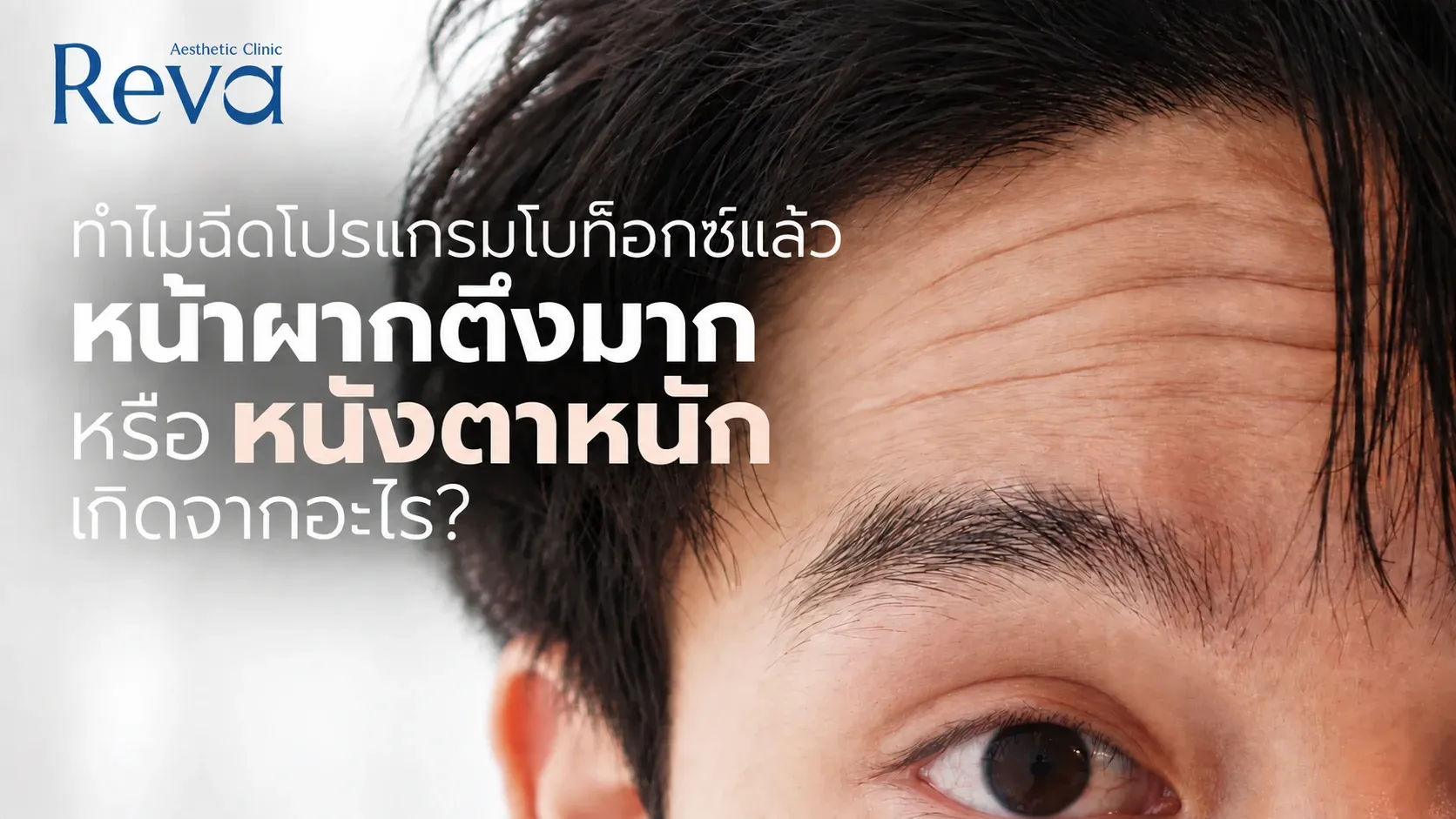 ฉีดโปรแกรมโบท็อกซ์แล้วหนังตาหนัก