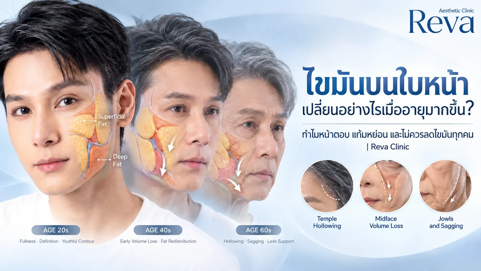 ไขมันบนใบหน้าเปลี่ยนอย่างไรเมื่ออายุมากขึ้น?