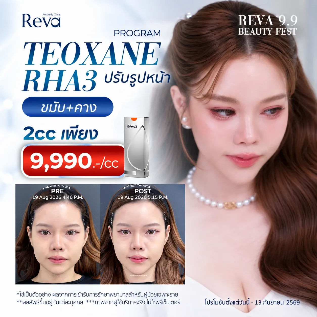 Program Teoxane RHA3
