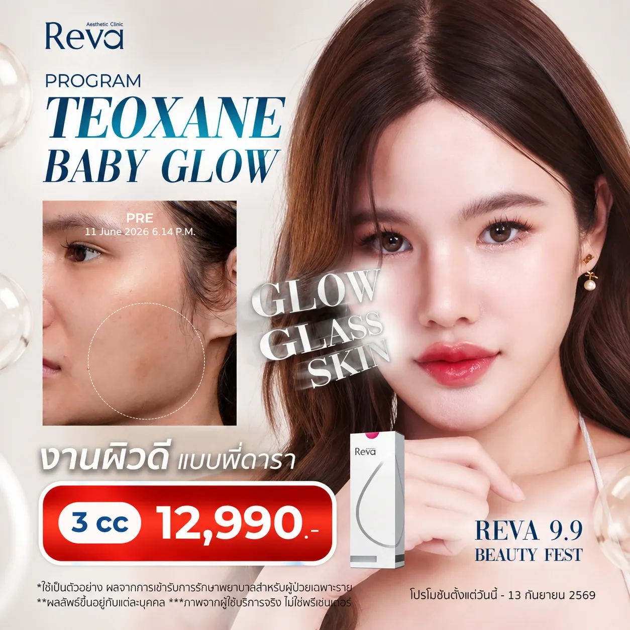 Program Teoxane Baby Glow
