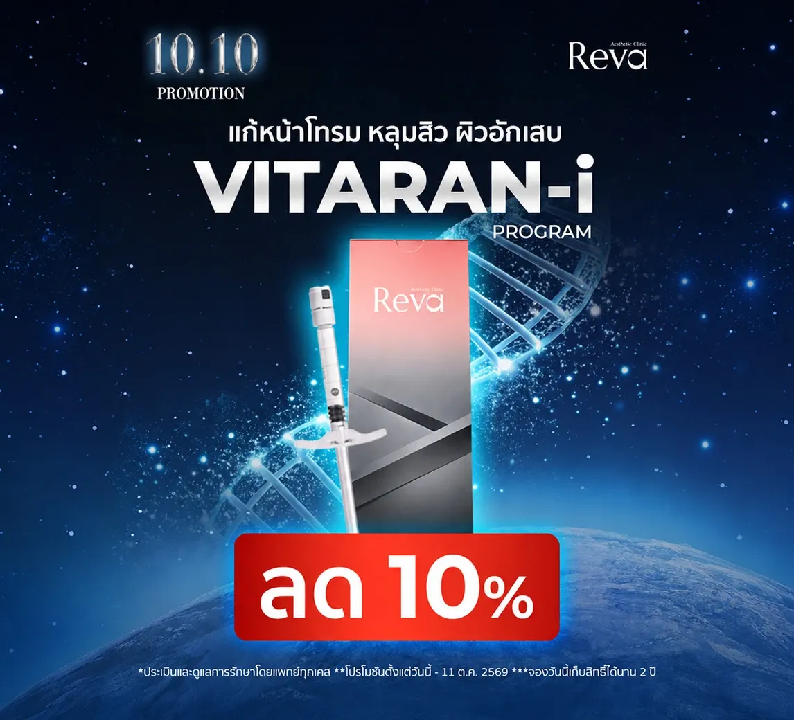 Program Vitaran-i