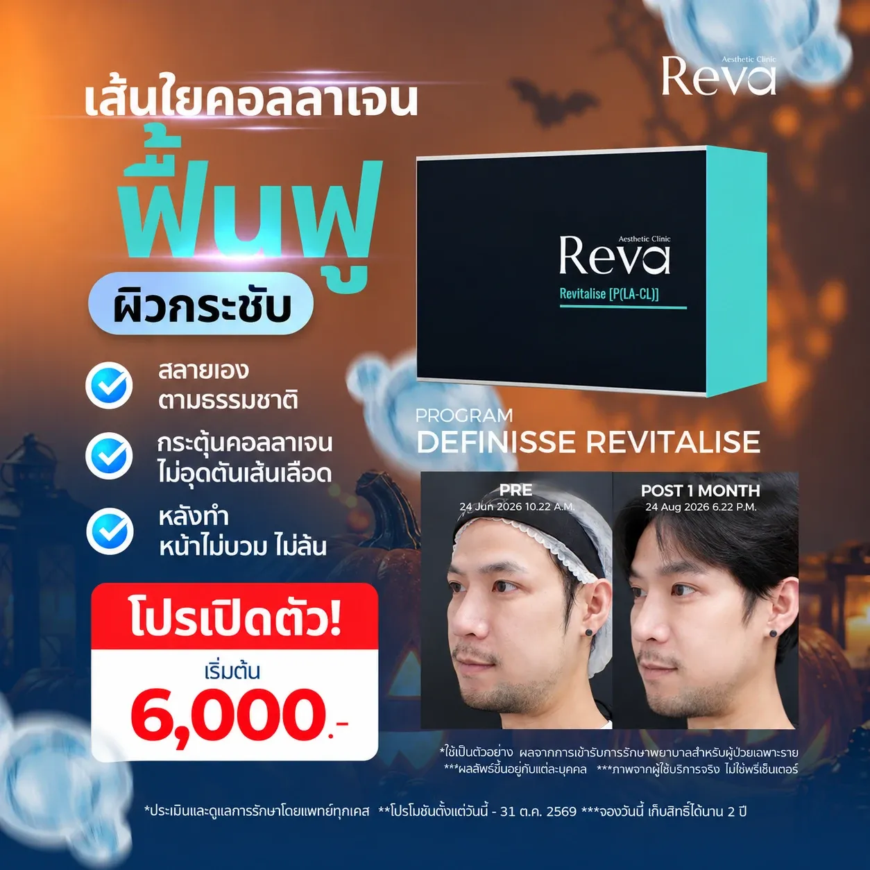 Definisse Revitalise Threads Program