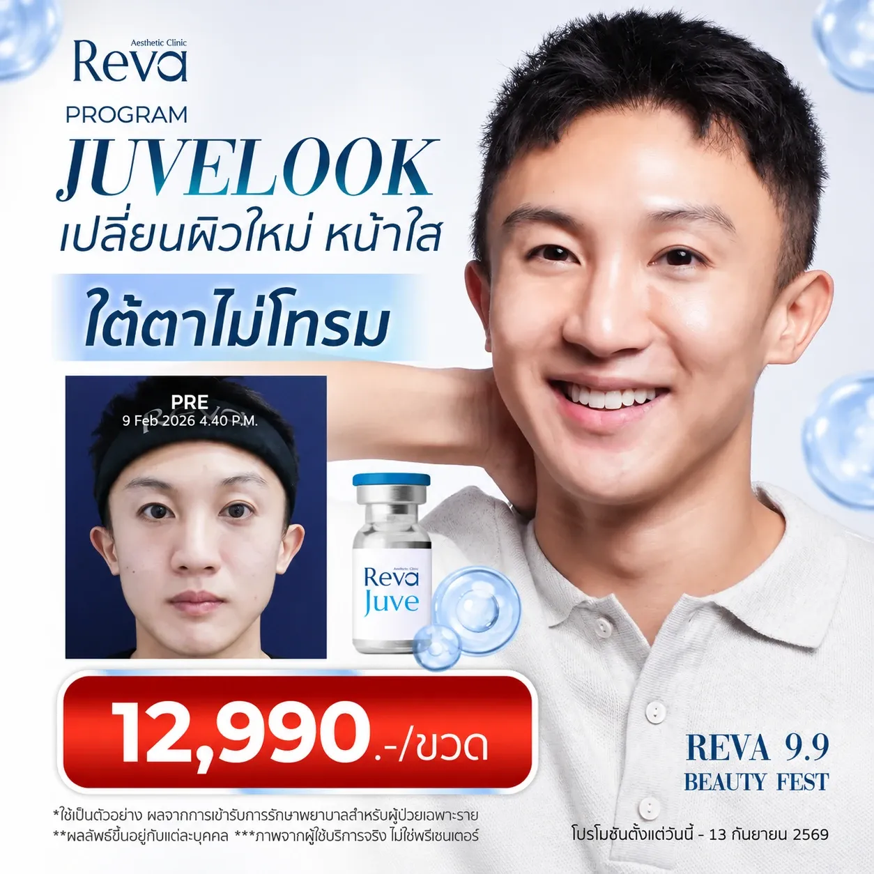 Program Juvelook