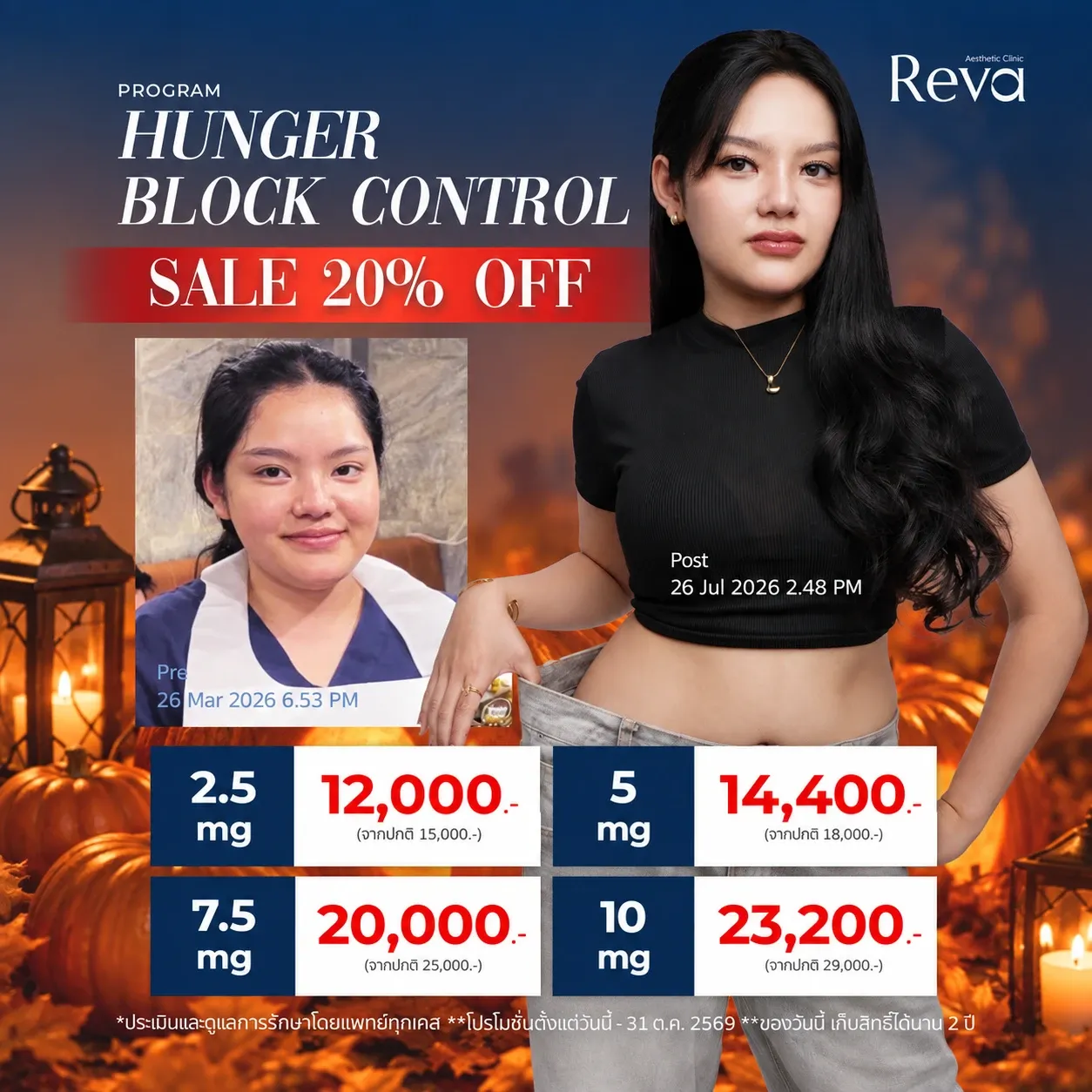 Hunger Block Control
