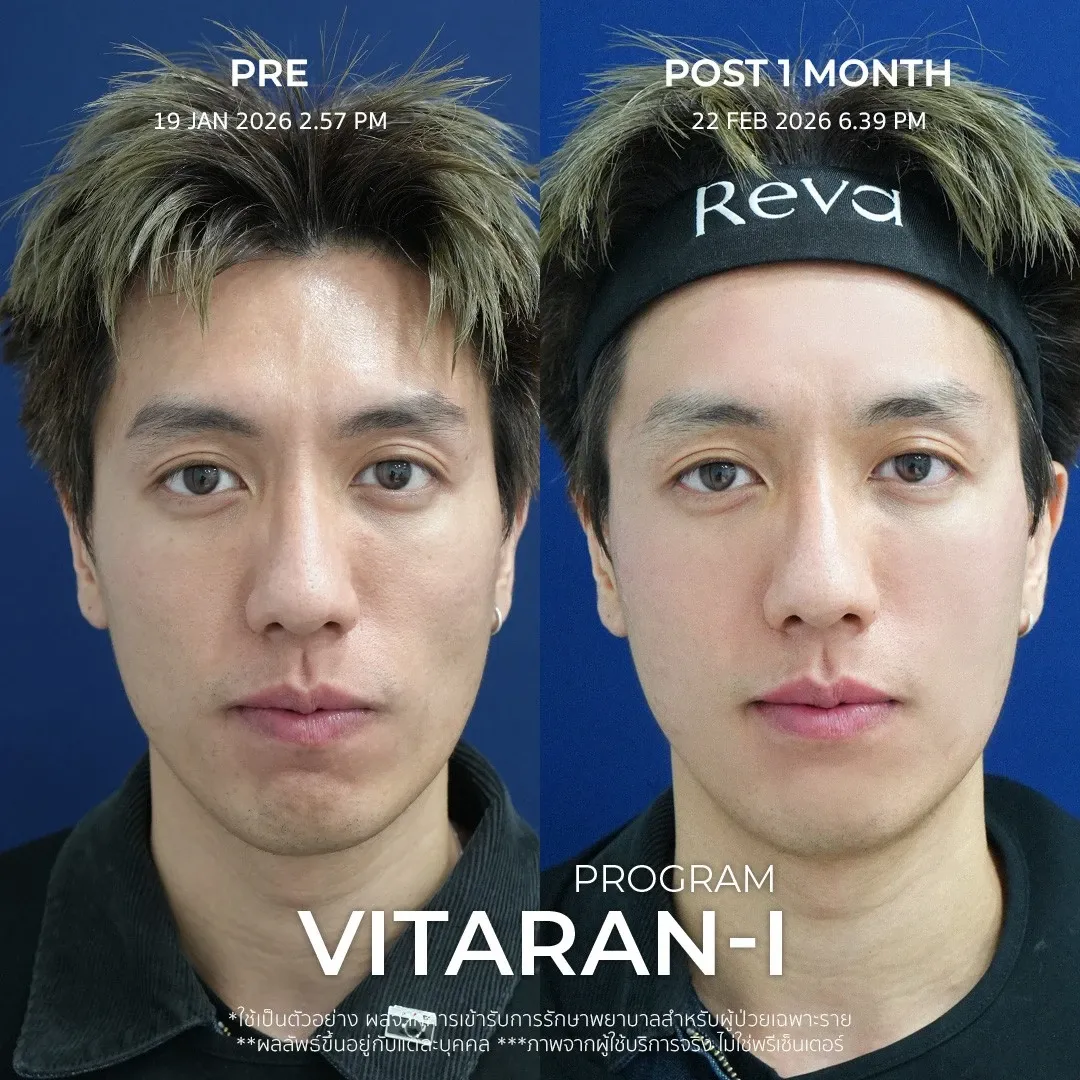 รีวิว vitaran
