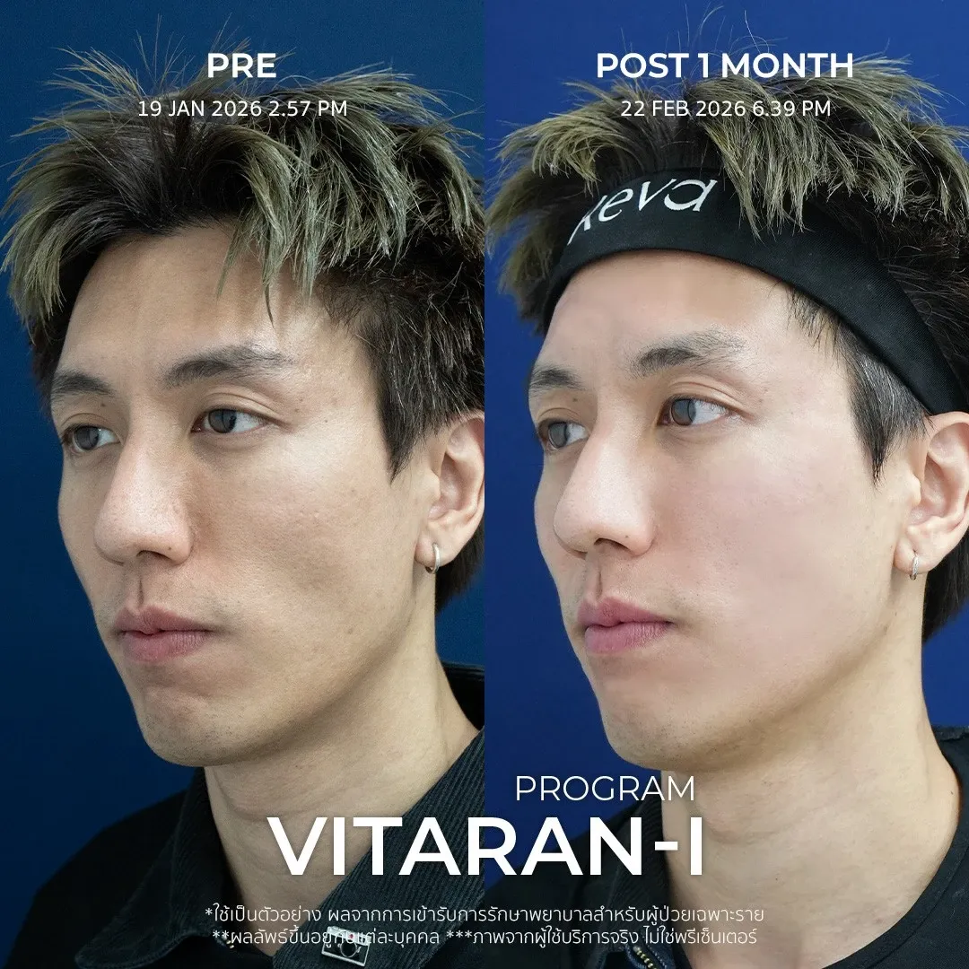 รีวิว vitaran