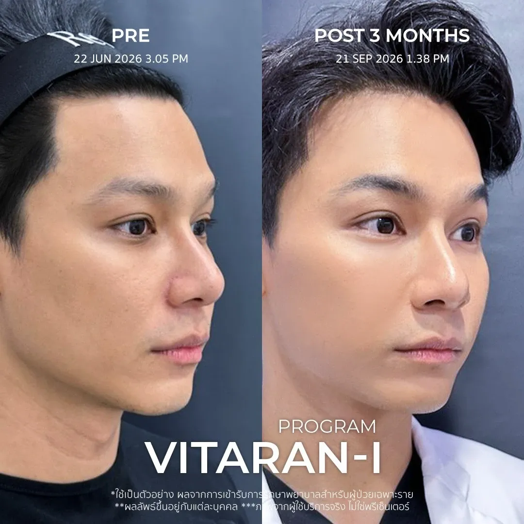 รีวิว vitaran