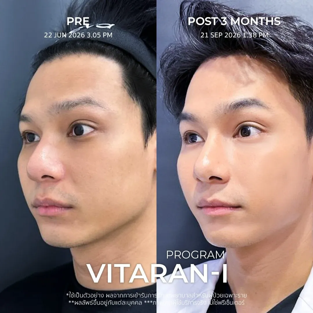 รีวิว vitaran