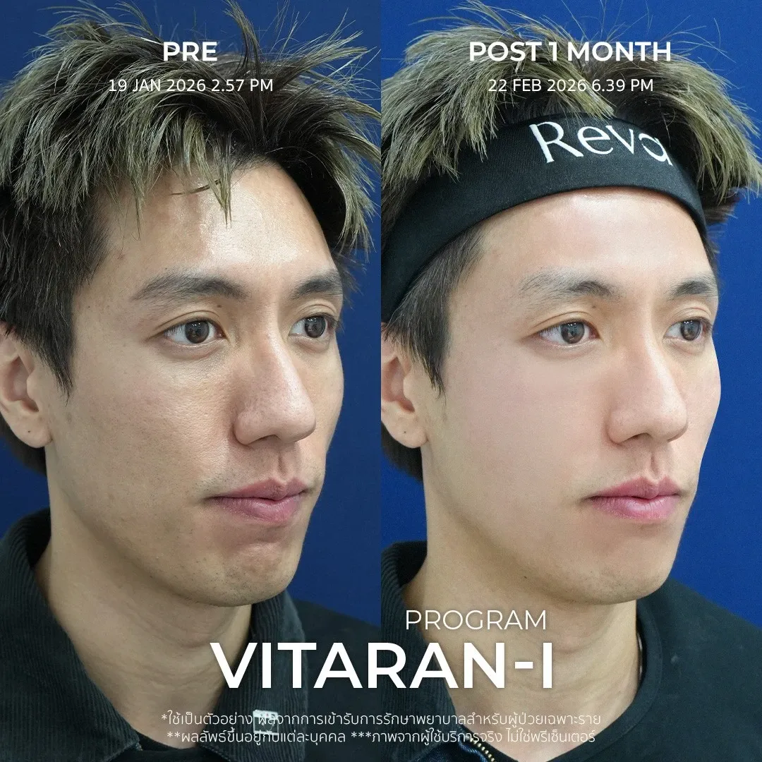 รีวิว vitaran