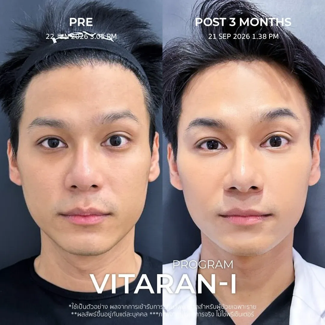 รีวิว vitaran
