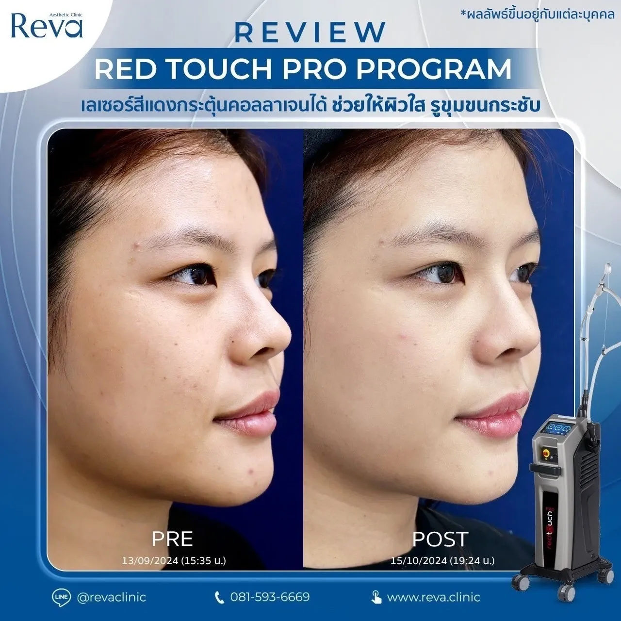 รีวิว red touch