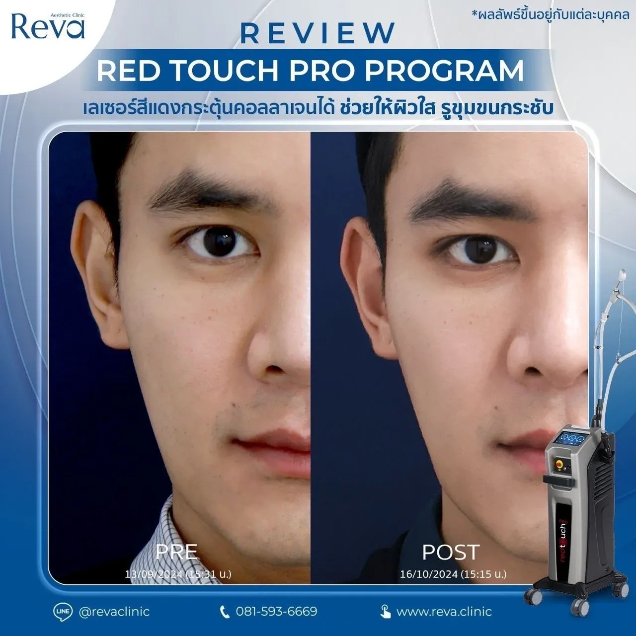 รีวิว red touch