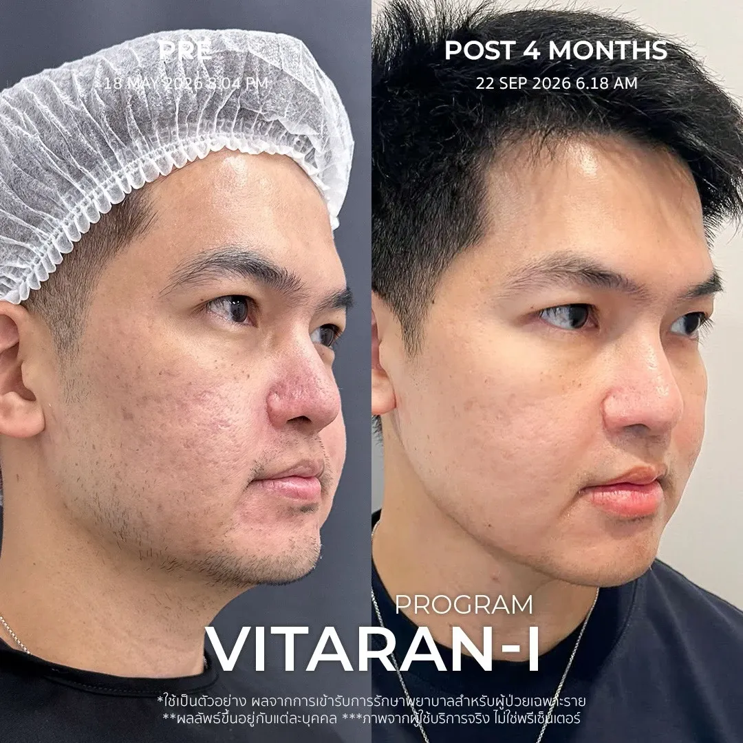 รีวิว vitaran