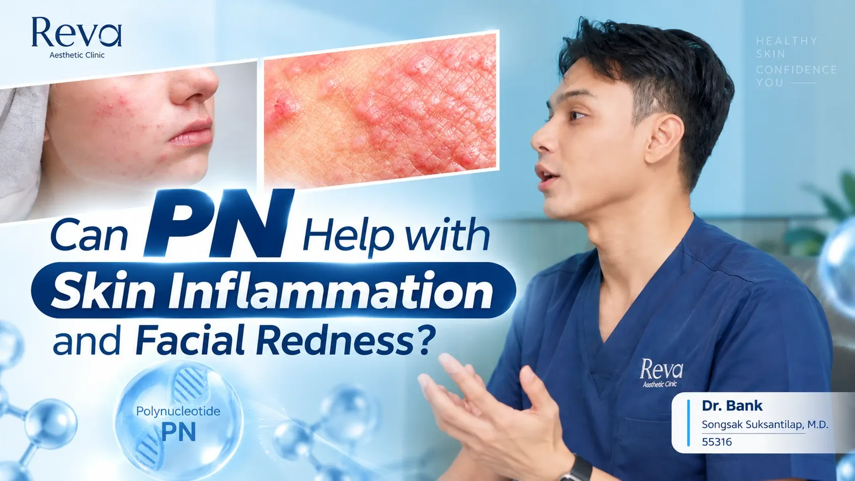 Vitaran Help with Skin Inflammation