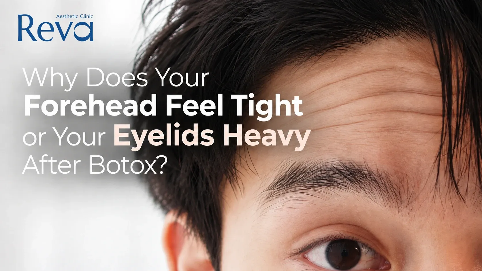 Why Do Your Eyelids Feel Heavy After a Botox Program?