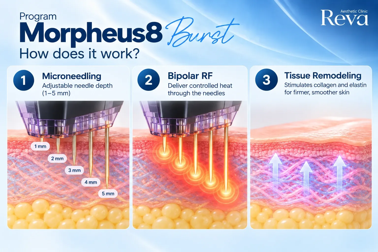 How Does Program Morpheus8 Burst Work