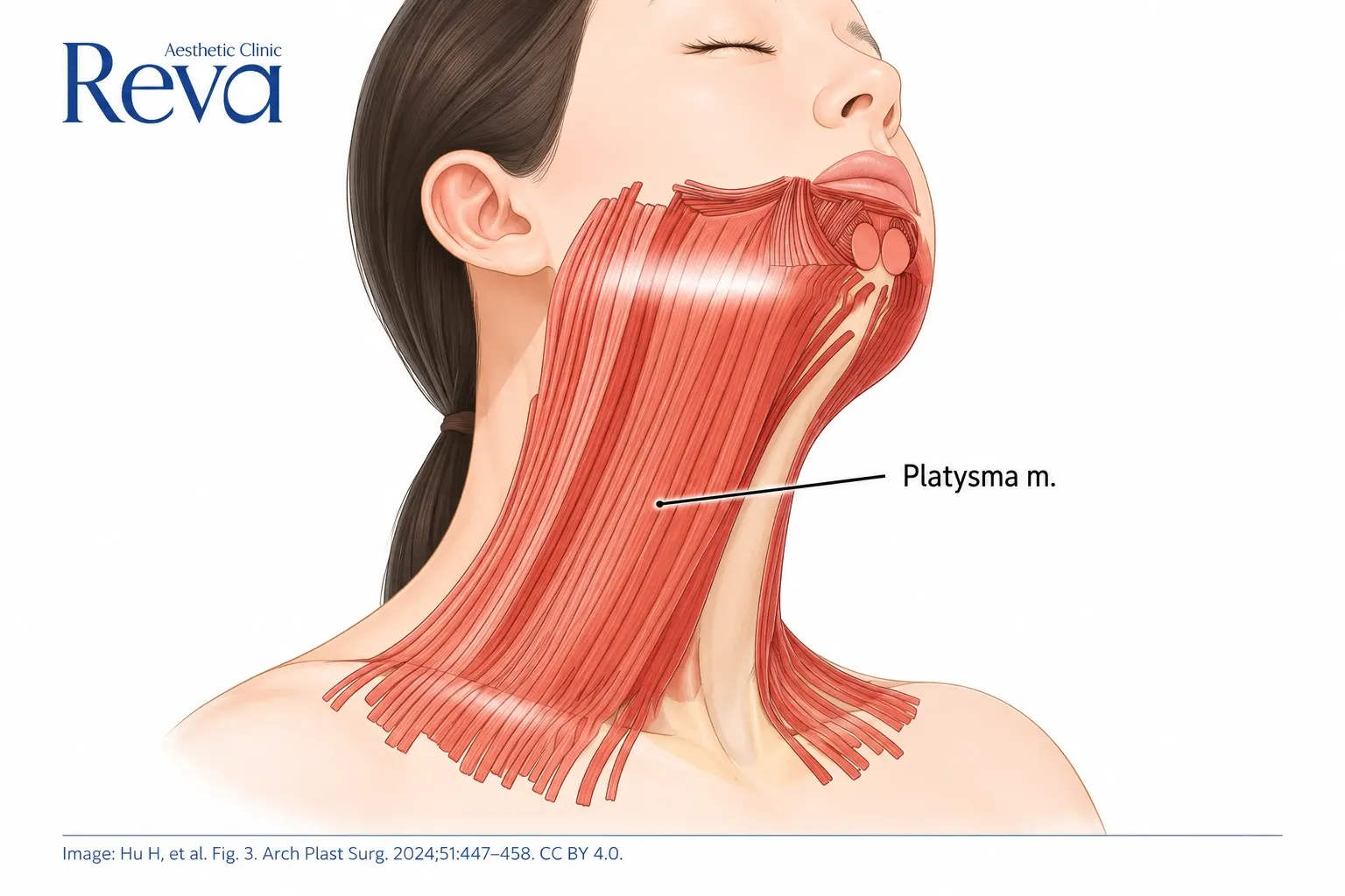 Platysma