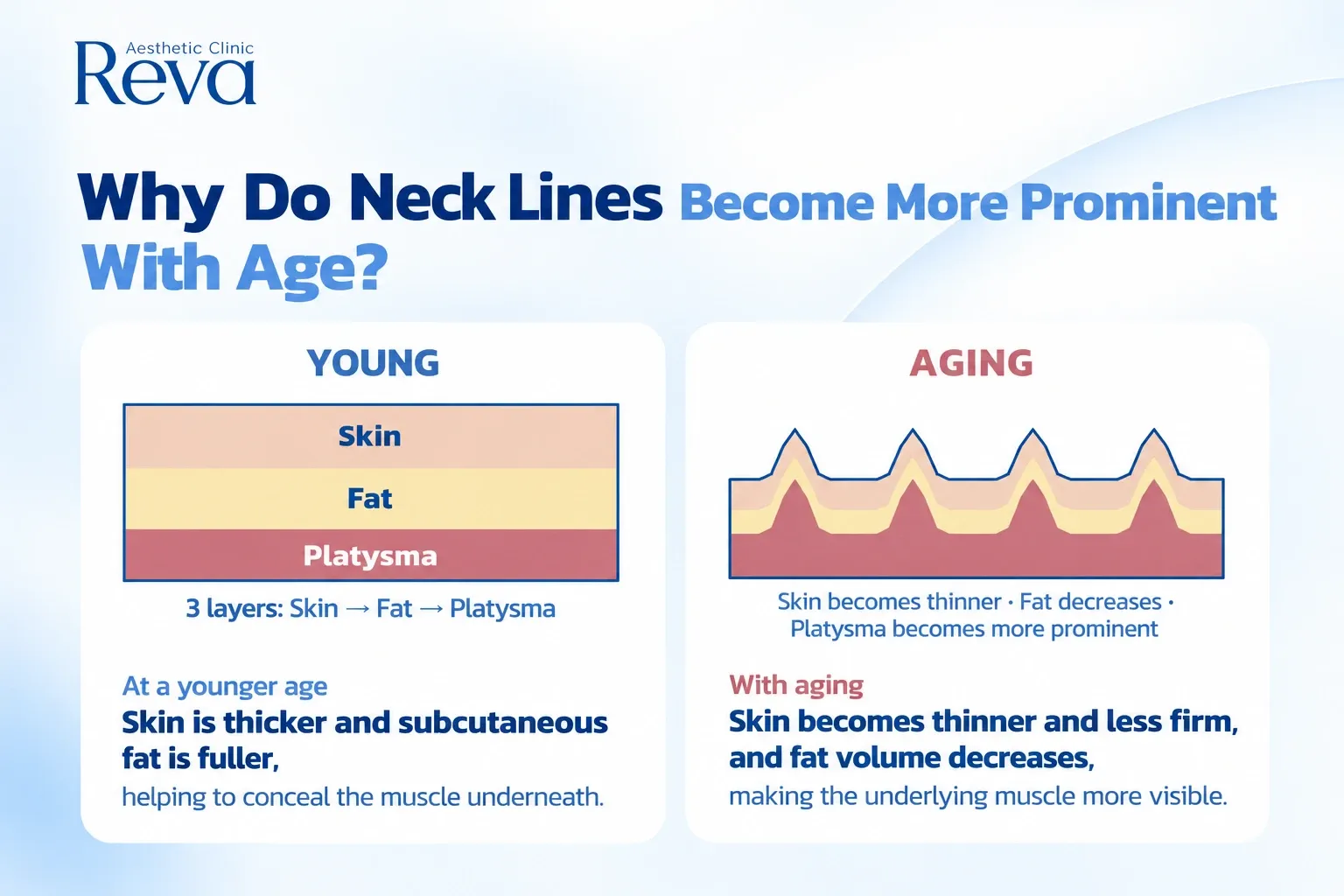 Why Do Platysma Bands Become More Visible With Age?