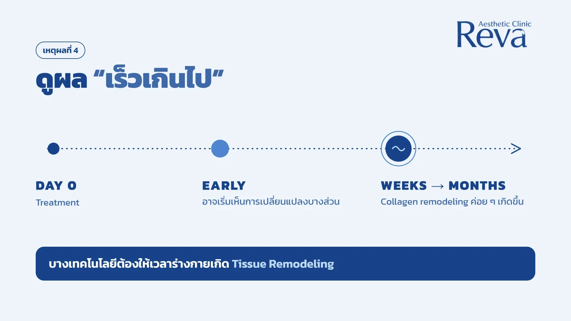  ดูผล “เร็วเกินไป”