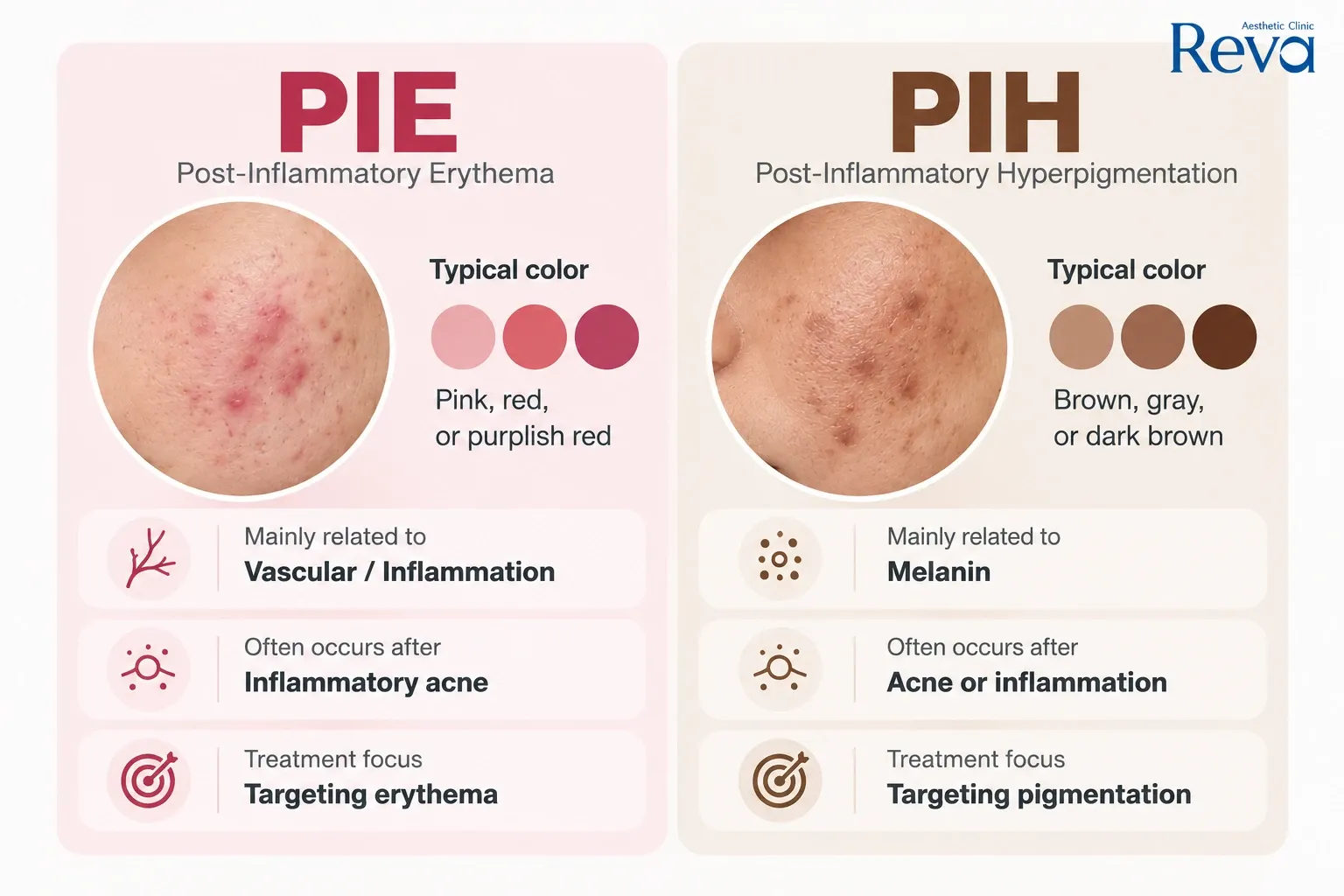 PIE vs PIH