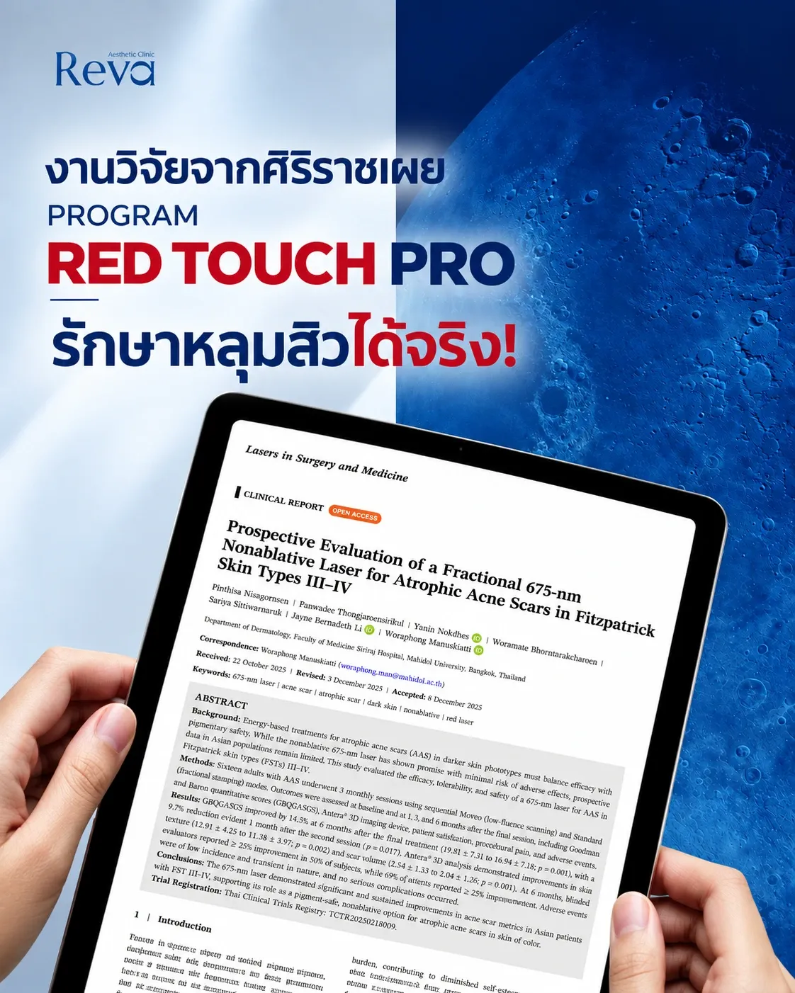 งานวิจัย Red touch pro