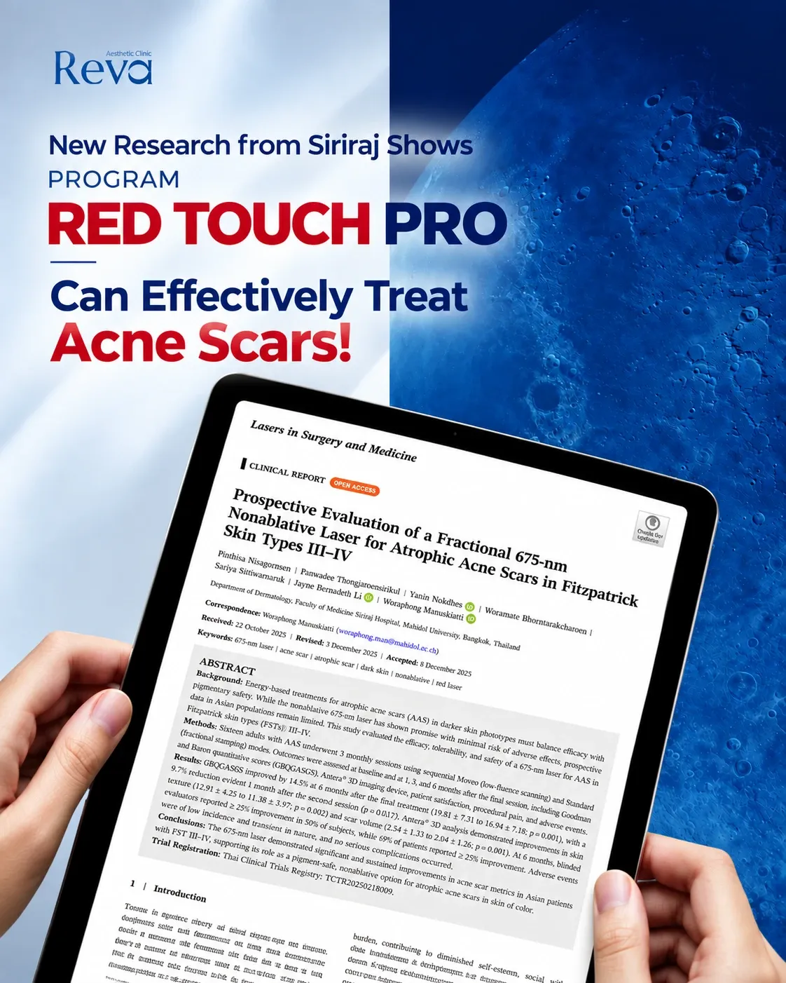 research about red touch pro