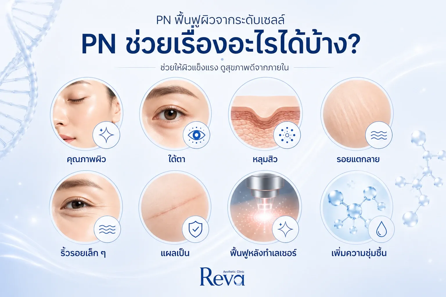 Medical infographic showing the clinical applications of Polynucleotide (PN) for skin rejuvenation, acne scars, under-eye treatment, scars, stretch ma