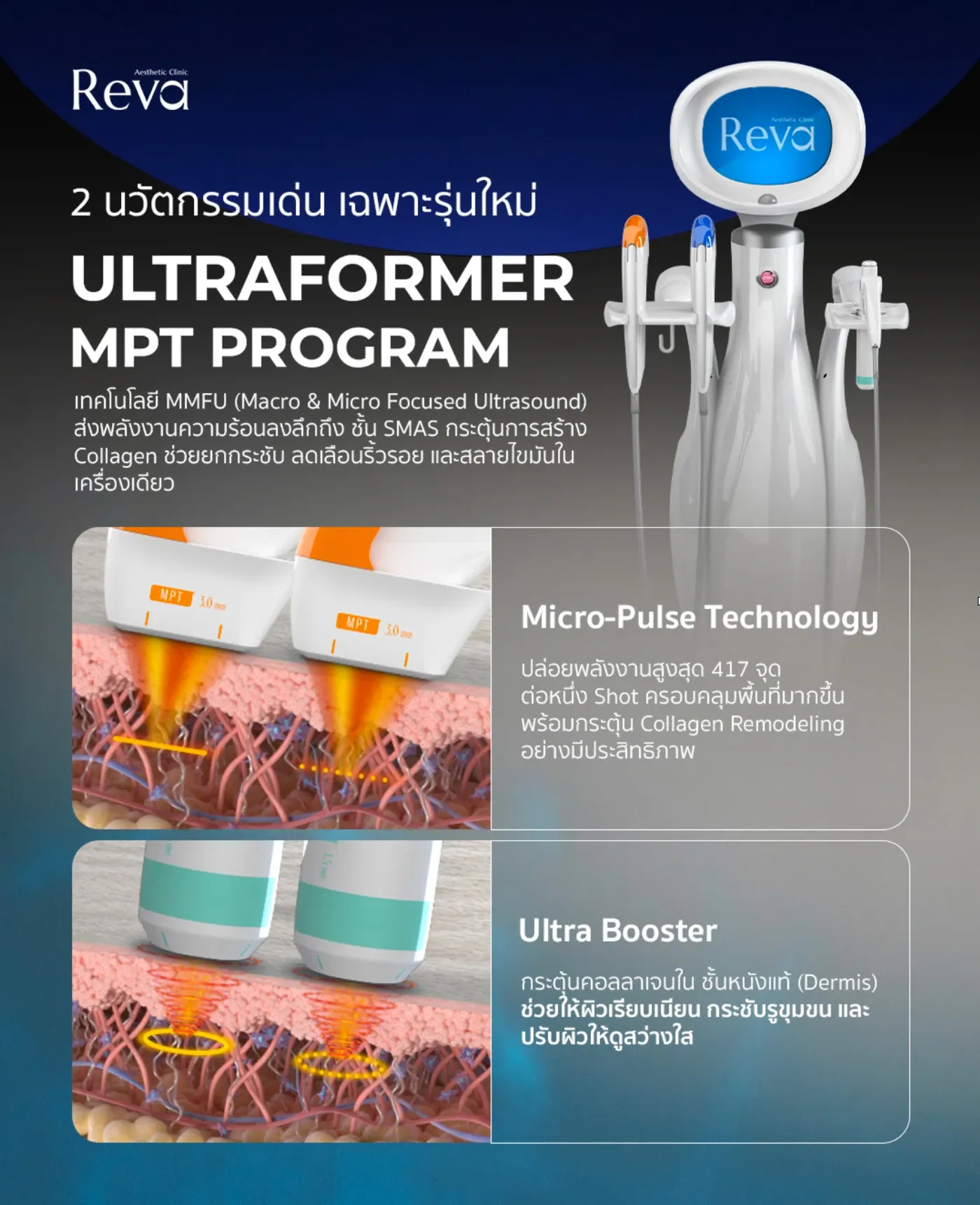 อินโฟกราฟิก Program Ultraformer MPT แสดง Micro-Pulse Technology และ Ultra Booster พร้อมเครื่องรักษา